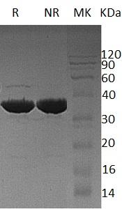 Human GALM/BLOCK25 (His tag) recombinant protein
