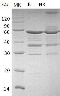 Human NOL3/ARC/NOP (GST tag) recombinant protein