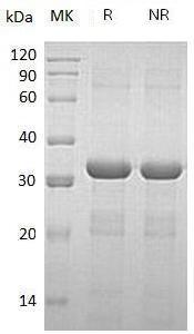 Human CORO6/PP1009/PP1782/PP1881 (His tag) recombinant protein