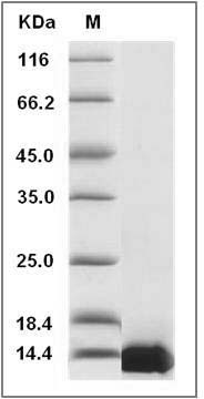 Human TFAP2C / AP2-GAMMA Protein (His Tag) SDS-PAGE