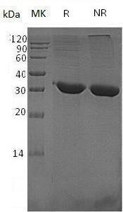 Human TPSB2/TPS2 (His tag) recombinant protein