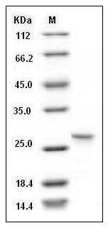 Mouse SDPR Protein (aa 2-180, His Tag) SDS-PAGE