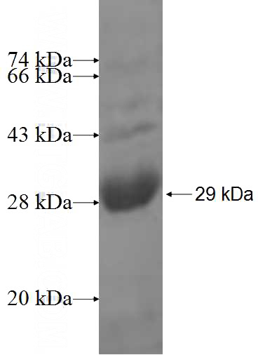 Recombinant Human RUSC1 SDS-PAGE