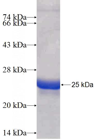 Recombinant Human NUDT10 SDS-PAGE