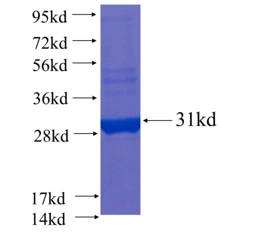 Recombinant human FAM116B SDS-PAGE