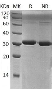 Human MERTK/MER (His tag) recombinant protein