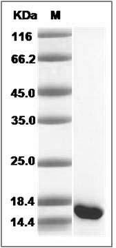 Human GMFB Protein SDS-PAGE