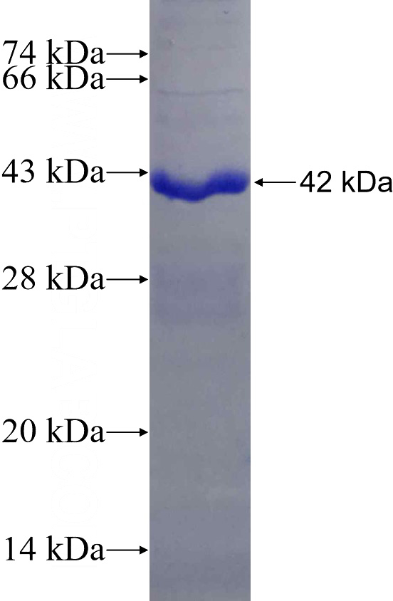 Recombinant Human CHRFAM7A SDS-PAGE