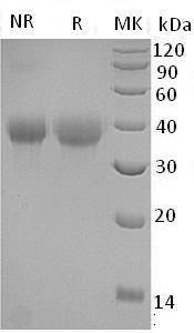 Human TNFRSF4/TXGP1L (His tag) recombinant protein