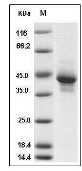 Mouse I-309 / CCL1 / TCA-3 Protein (Fc Tag) SDS-PAGE