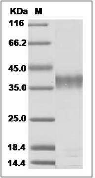 Human RBKS / Ribokinase Protein (His Tag) SDS-PAGE