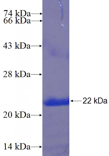 Recombinant Human C16orf63 SDS-PAGE