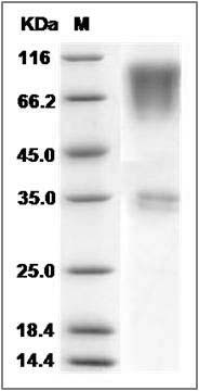 Rat CD164 / Endolyn Protein (Fc Tag) SDS-PAGE
