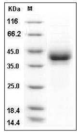 Mouse CD209B / DC-SIGNR1 Protein (His Tag) SDS-PAGE