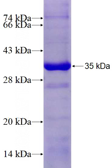 Recombinant Human TRIM21 SDS-PAGE