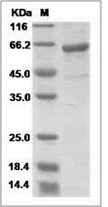 Influenza A H5N8 (A/breeder duck/Korea/Gochang1/2014) Hemagglutinin / HA Protein (His Tag)