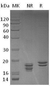 Human VMO1/UNQ6350/PRO21055 (His tag) recombinant protein