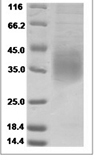 Mouse CD47 Protein 15526