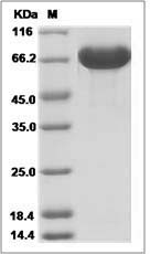 Human A1BG / alpha 1B-Glycoprotein Protein (His Tag)