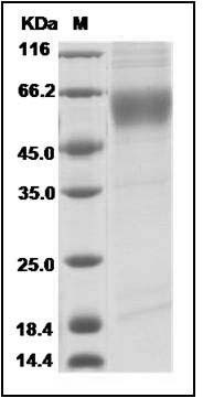 Influenza A H5N1 (A/Egypt/ 3300-NAMRU3/2008) Hemagglutinin Protein (HA1 Subunit) (His Tag) SDS-PAGE