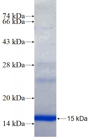Recombinant Human SYNGR4 SDS-PAGE