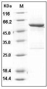 Human SPG21 Protein (GST Tag) SDS-PAGE