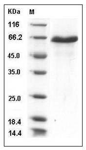 Mouse DLL1 / Delta-1 Protein (His Tag) SDS-PAGE