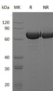 E.coli uidA/gurA/gusA/b1617/JW1609 (His tag) recombinant protein