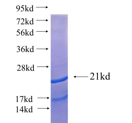 Recombinant human RUNDC3A SDS-PAGE