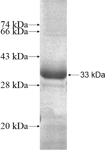 Recombinant Human ANKMY1 SDS-PAGE