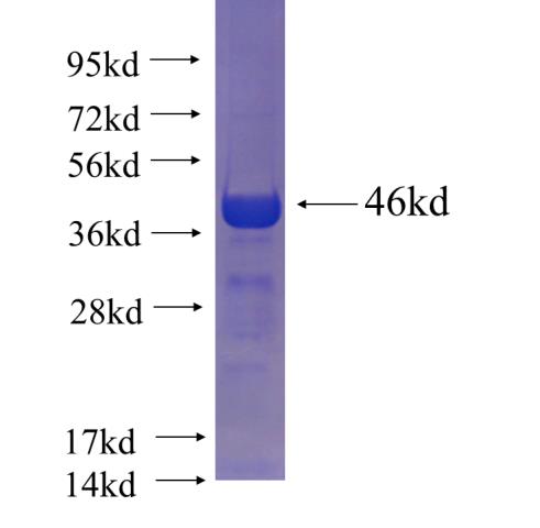 Recombinant human CCDC66 SDS-PAGE