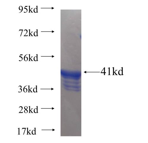 Recombinant Arabidopsis thaliana HEMC SDS-PAGE
