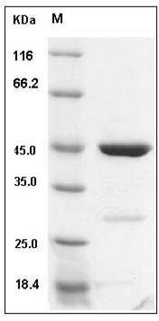 Human CDKN2D / p19ink4d Protein (GST Tag) SDS-PAGE