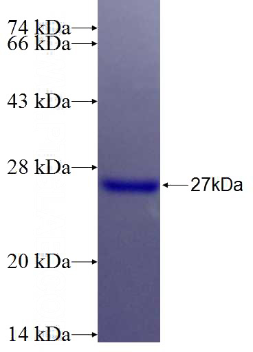 Recombinant Human NLRP10 SDS-PAGE