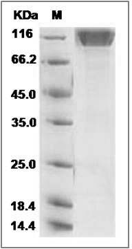 Human SEZ6L2 / PSK-1 Protein (His Tag) SDS-PAGE