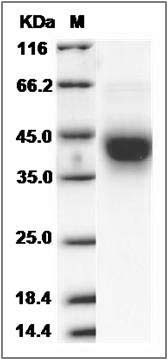 Cynomolgus IFNGR / IFNGR1 Protein (His Tag) SDS-PAGE