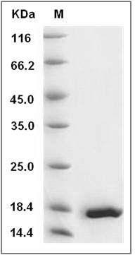 Human IL20 / Interleukin-20 Protein SDS-PAGE