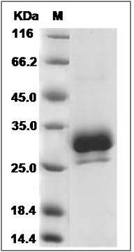 Rat Ephrin-B3 / EFNB3 Protein (His Tag) SDS-PAGE