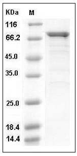 Human CDK16 / PCTAIRE1 / PCTK1 Protein (GST Tag) SDS-PAGE