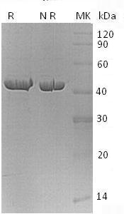 Human CPA1/CPA (His tag) recombinant protein