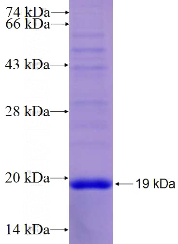 Recombinant Human GP9 SDS-PAGE