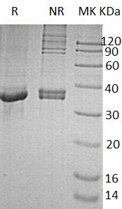 Human STAT5B (His tag) recombinant protein