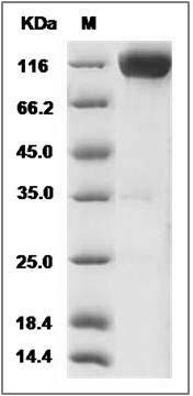 Rat KIT / c-KIT Protein (Fc Tag) SDS-PAGE