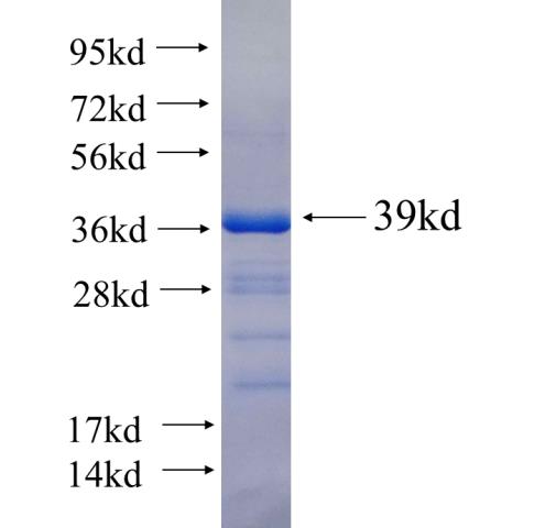 Recombinant human CYP46A1 SDS-PAGE