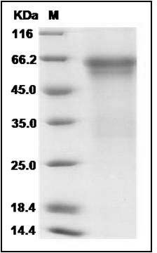 Mouse HVEM / TNFRSF14 Protein (His & Fc Tag) SDS-PAGE