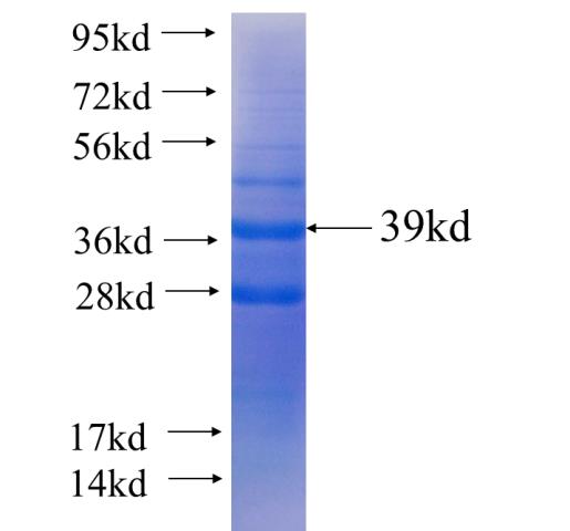 Recombinant human ATE1 SDS-PAGE