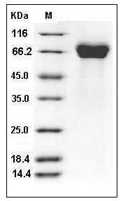 Influenza A H5N1 (A/Hong Kong/483/97) Hemagglutinin / HA Protein (His Tag) SDS-PAGE
