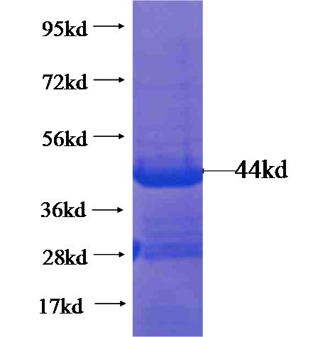 Recombinant human C9orf41 SDS-PAGE