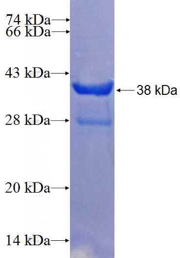Recombinant Human C10orf104 SDS-PAGE