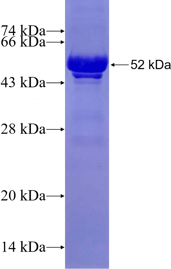 Recombinant Human GRAMD1B SDS-PAGE